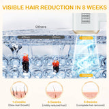 Ice Cooling Fda Cleared Ipl Permanent Hair Removal Device
